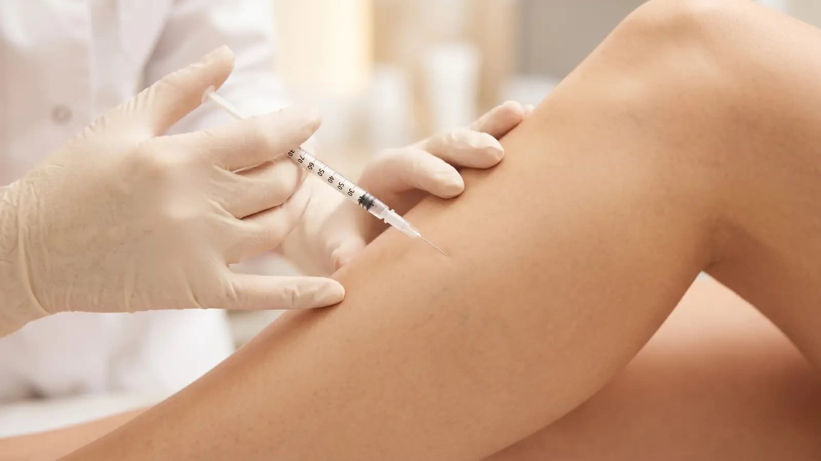 Spider Vein Treatment