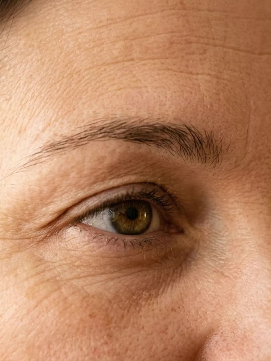 Fine Lines & Wrinkles