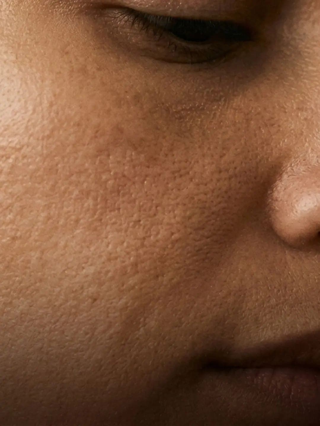 Skin Tone & Texture