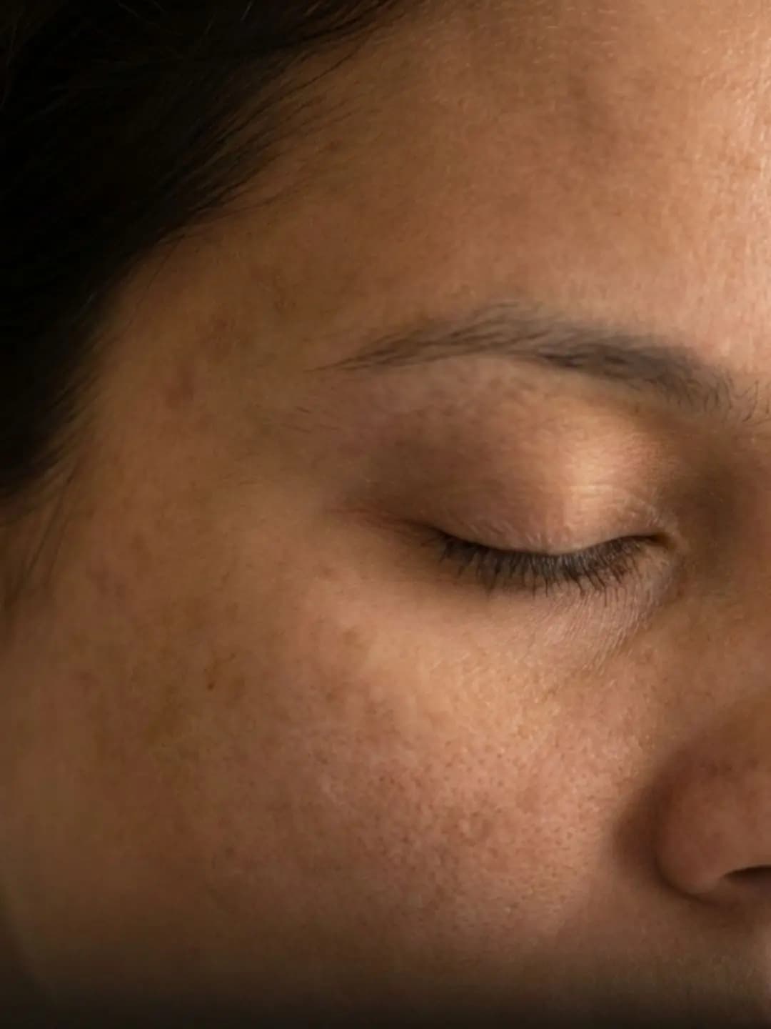 Dull Skin & Uneven Tone