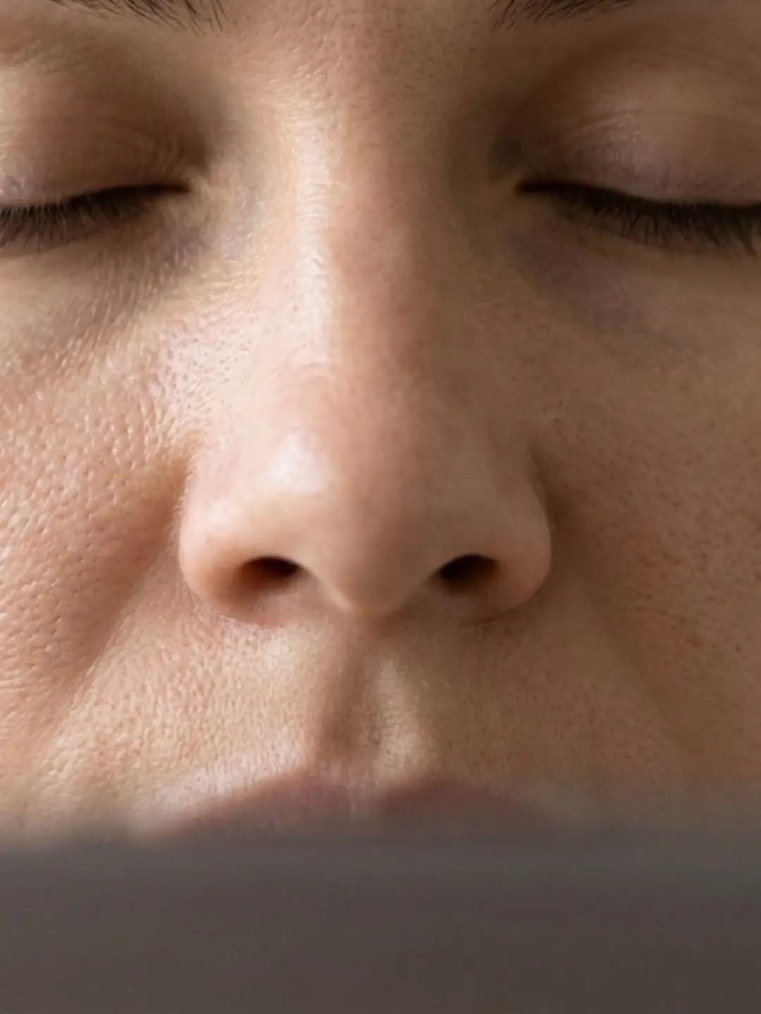 Enlarged Pores & Texture