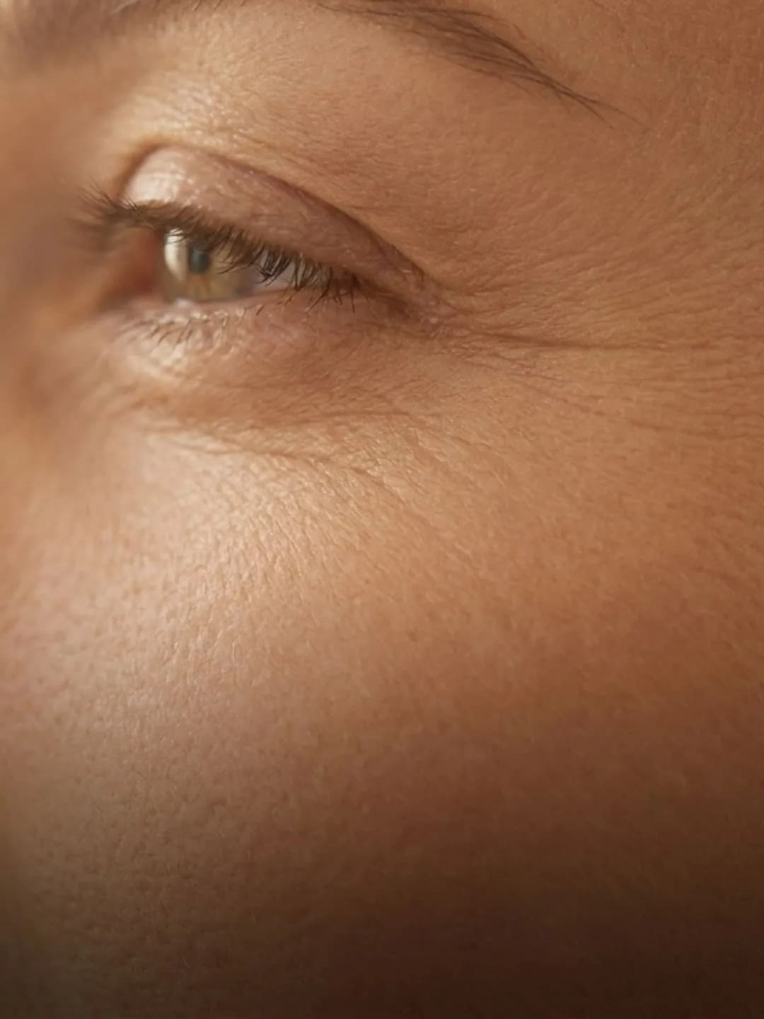 Fine Lines & Early Aging